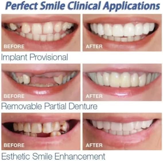 Smile Teeth One time fits all Cosmetic Natural