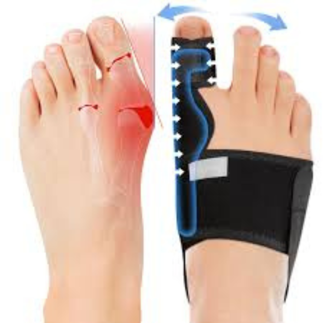 Bunion Corrector