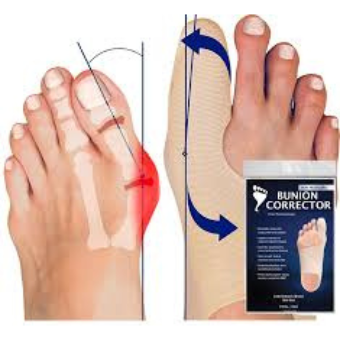 Bunion Corrector