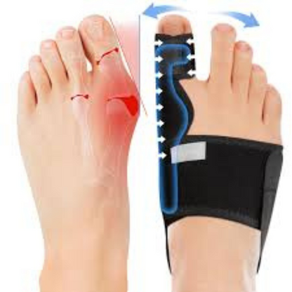 Bunion Corrector