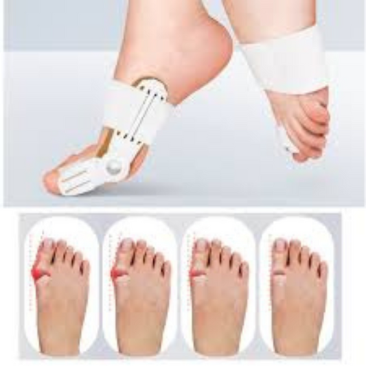Bunion Corrector